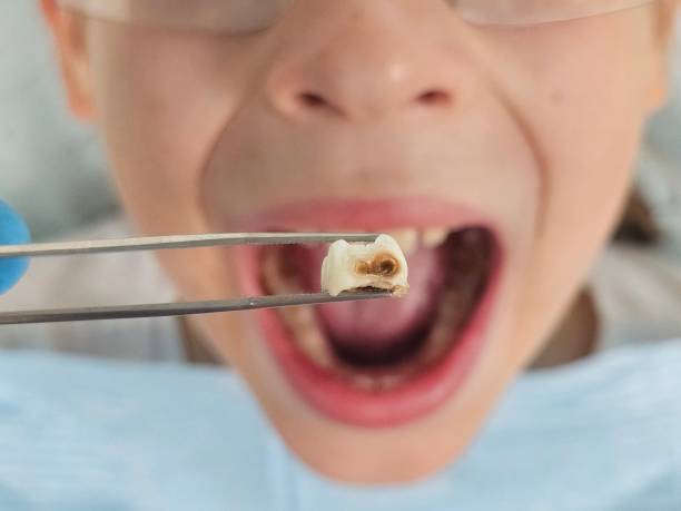 Best Emergency Gum Treatment in South Gate, CA